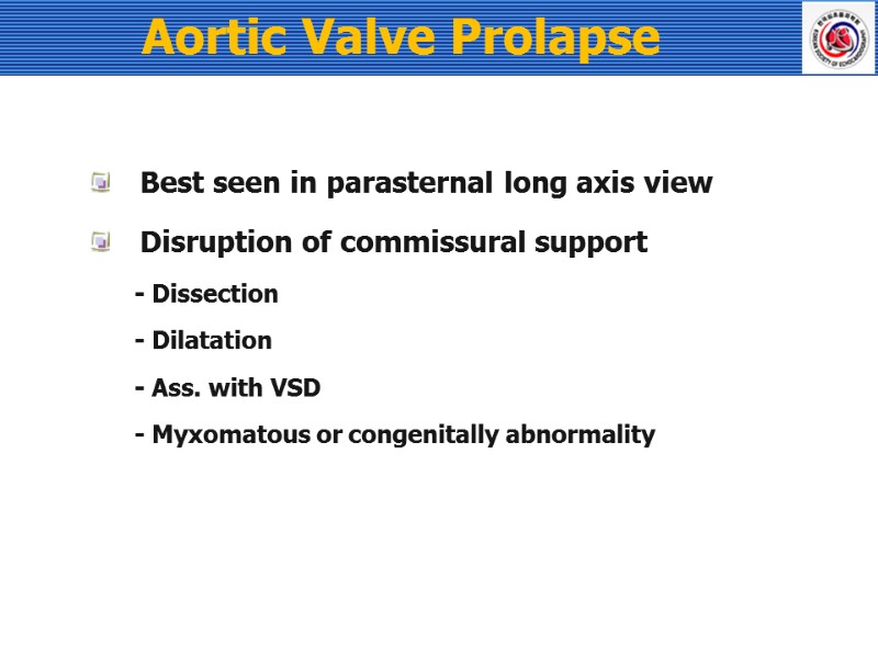 Aortic Valve Prolapse Best seen in parasternal long axis view Disruption of commissural support